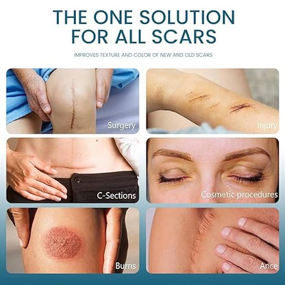 Crema para eliminar cicatrices Scar Gel™ | No más cicatrices. Solo piel renovada