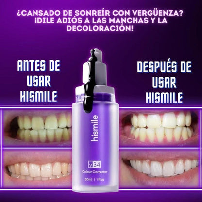 Hismile v34 - Crema Blanqueadora Dental